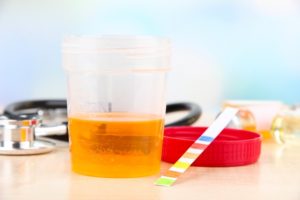 Drug and Alcohol Testing in the Workplace